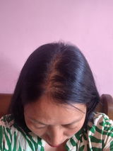 Anonymous review photo