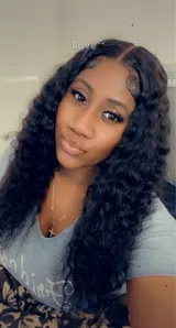 Dyshea review photo
