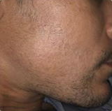 Rakesh G. review photo