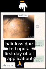 Lupus warrior review photo