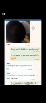 Thomas- male pattern baldness review photo