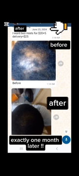 Thomas- male pattern baldness review photo