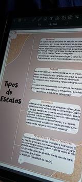 Noe review photo