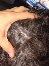 Anonymous review photo
