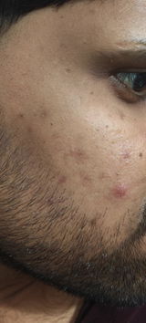 Fahad ali review photo