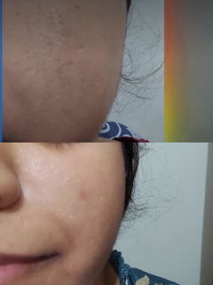 Review picture