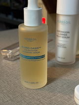 Allen NG review photo