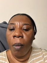 Anonymous review photo