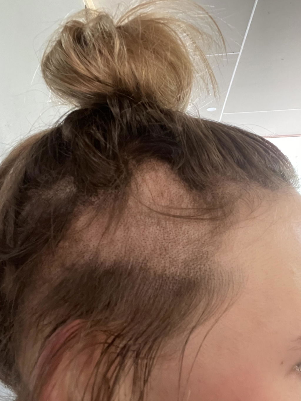 Hair Growth Oil