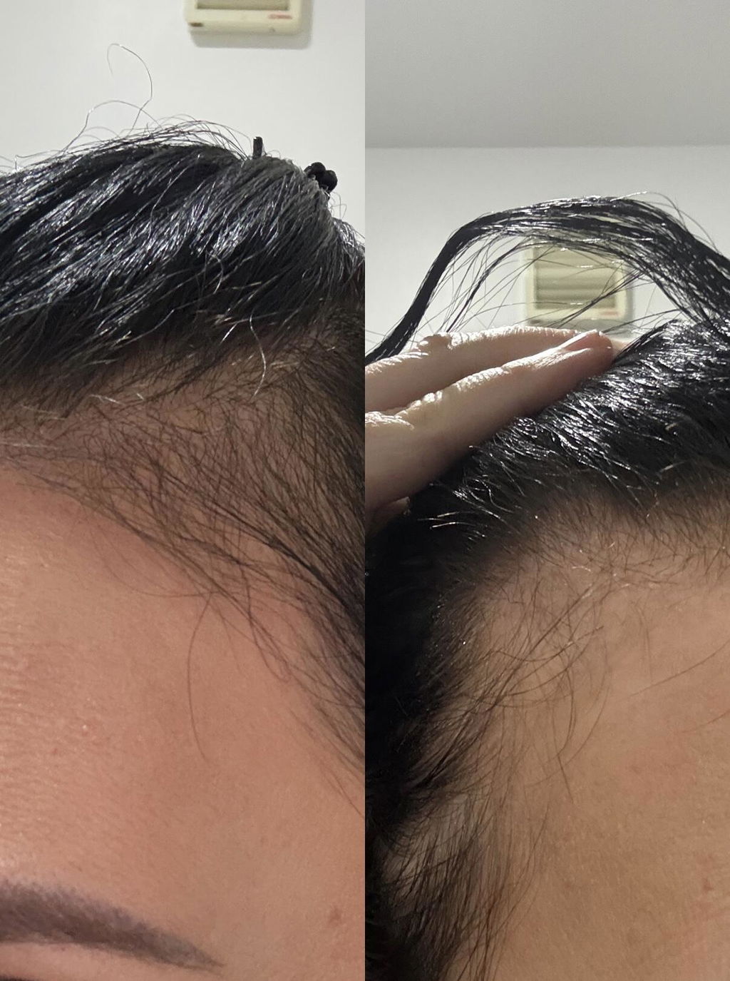 Hair Growth Oil