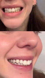Ana review photo