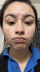 Jaira Betancourt review photo