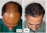 Prakash Fasle review photo