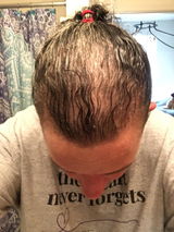 Anonymous review photo