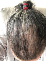 Anonymous review photo