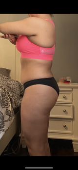 Anonymous review photo