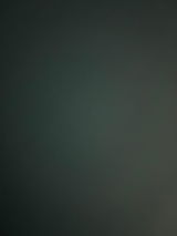 Anonym review photo