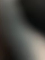 Anonym review photo