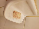 Anonymous review photo