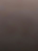 Anonym review photo