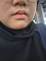 Anonymous review photo