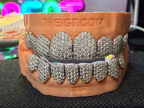 Custom Fully Iced Honeycomb Rimless Setting Grillz