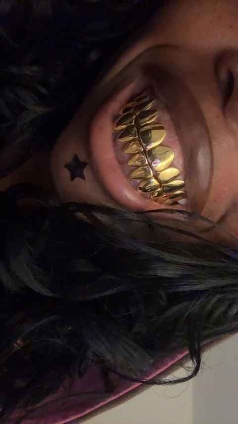 Custom Polished Yellow Gold Grillz