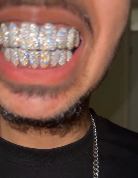 Custom Fully Iced Honeycomb Rimless Setting Grillz