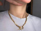 Anonym review photo