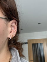 Anonym review photo