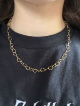 Anonym review photo