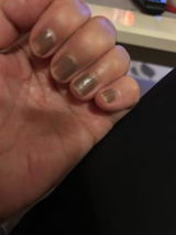 Herdis review photo