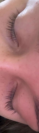 Anonym review photo