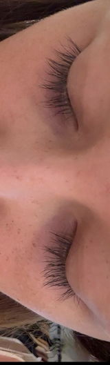 Anonym review photo