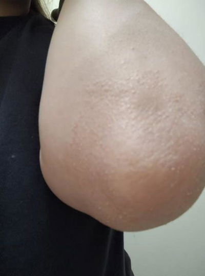 vlerësim i një klienteje për kremin për psoriazë dhe ekzemë nga InaEssentials