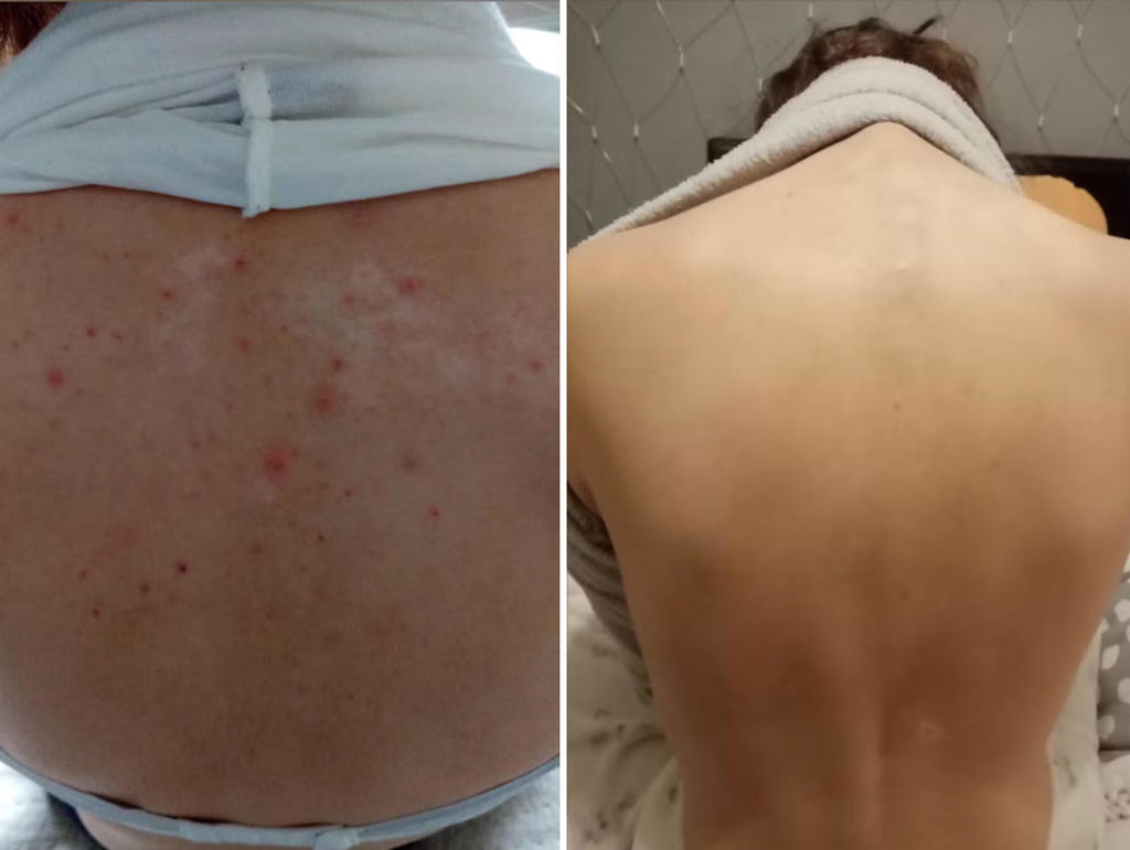 Organická Levandulová voda - Hydrolina pro Akné
