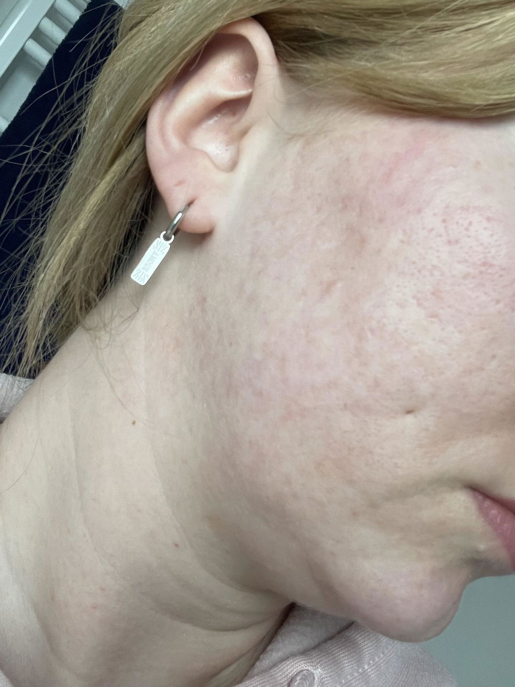 Hydrobiotic - Lavande & Menthe - soins intensifs pour l'Acné