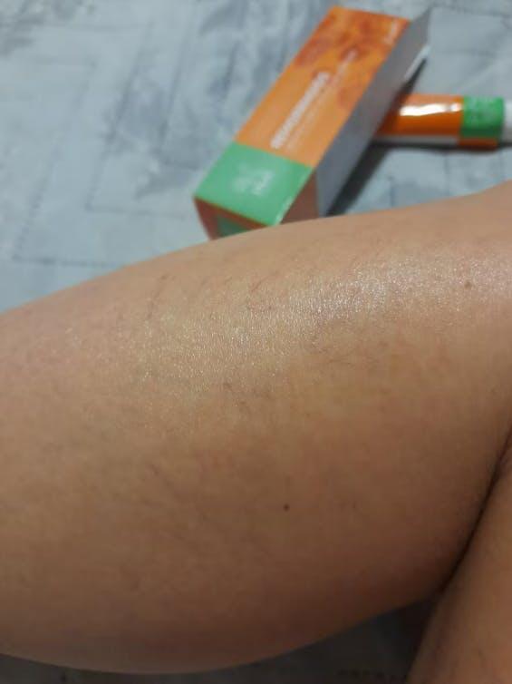 Photo from a buyer review of the horse chestnut cream from InaEssentials