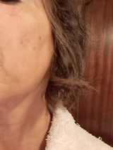 Água de Abeto Branco Orgânica - Hydrolina para Hiperpigmentação