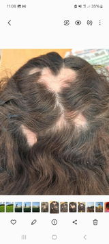 Champô Natural de Urtiga Selvagem para Queda de Cabelo