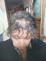 Champô Natural de Urtiga Selvagem para Queda de Cabelo