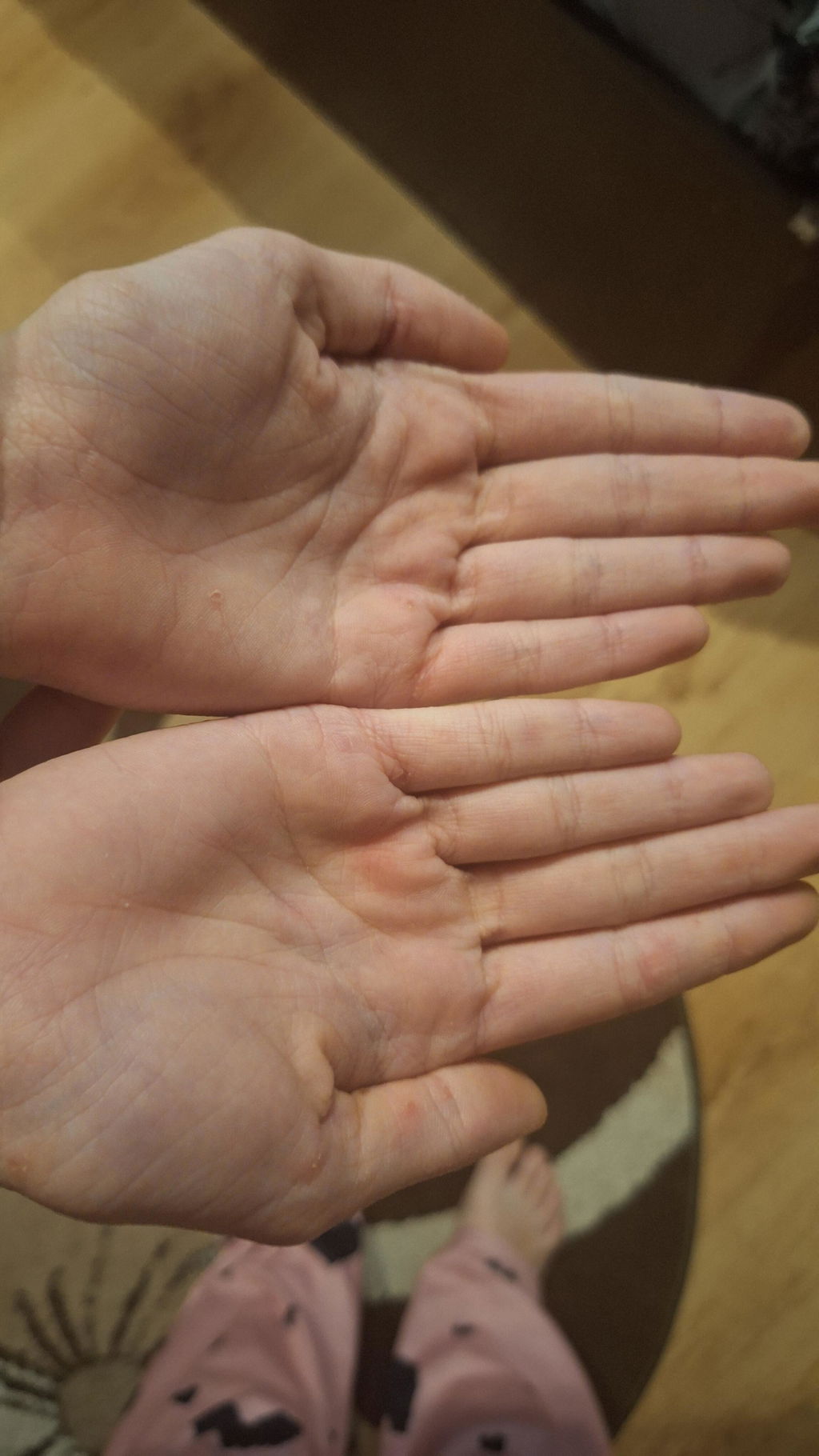 Cumpără 2 creme pentru psoriazis, eczeme și piele iritată și primești gratuit 2 Hydrobiotic Mușețel și Melissa