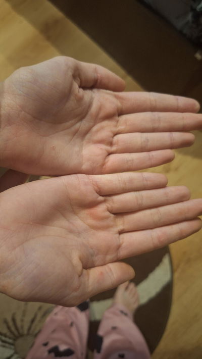 părerea unei cliente despre crema pentru psoriazis și eczeme de la InaEssentials