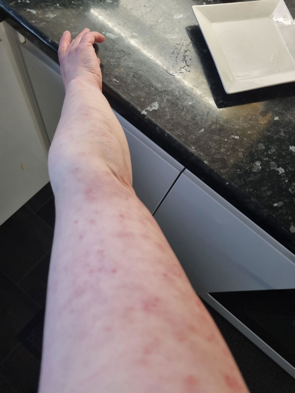 Wild Saint John’s Wort Water - Hydrolina for Psoriasis and Irritated skin
