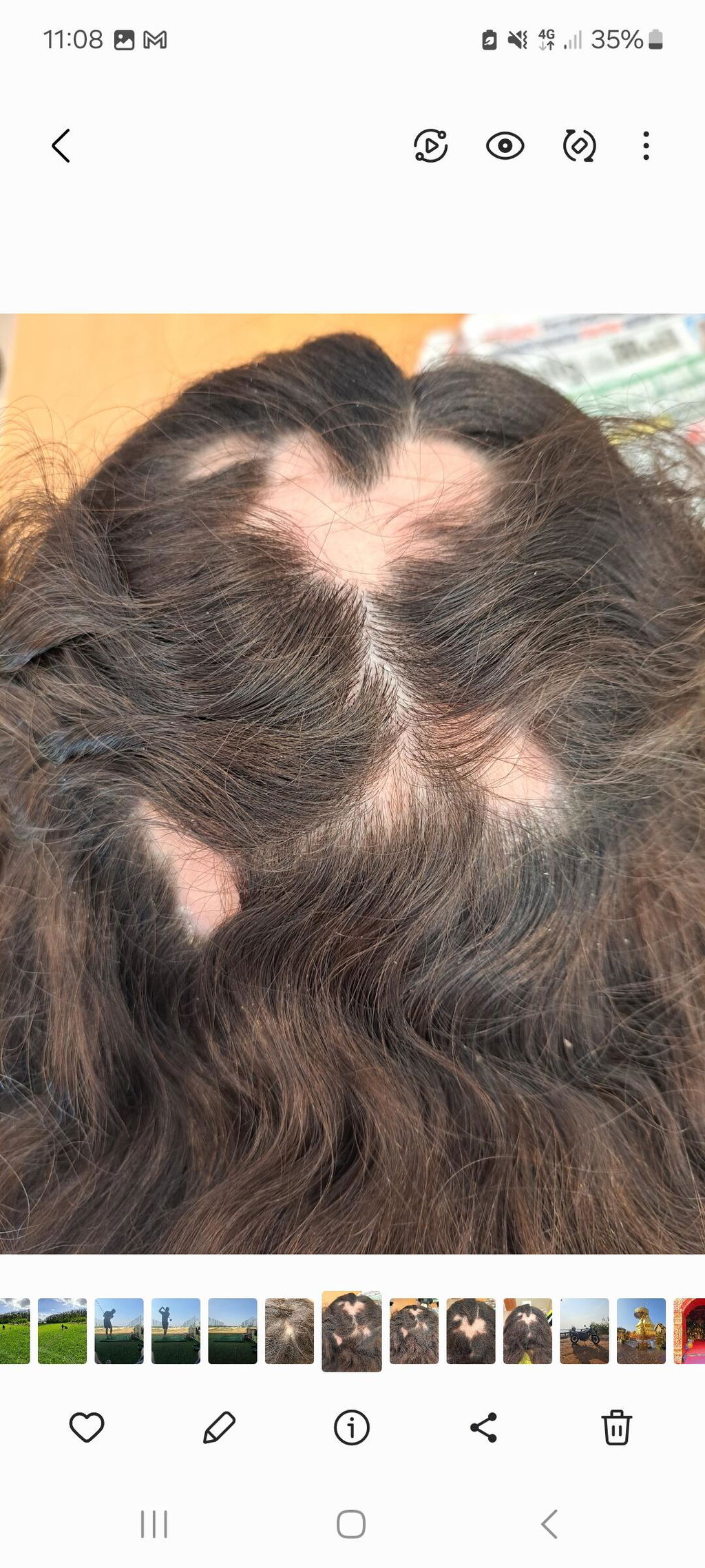 Natural Wild Nettle Shampoo for Hair Loss