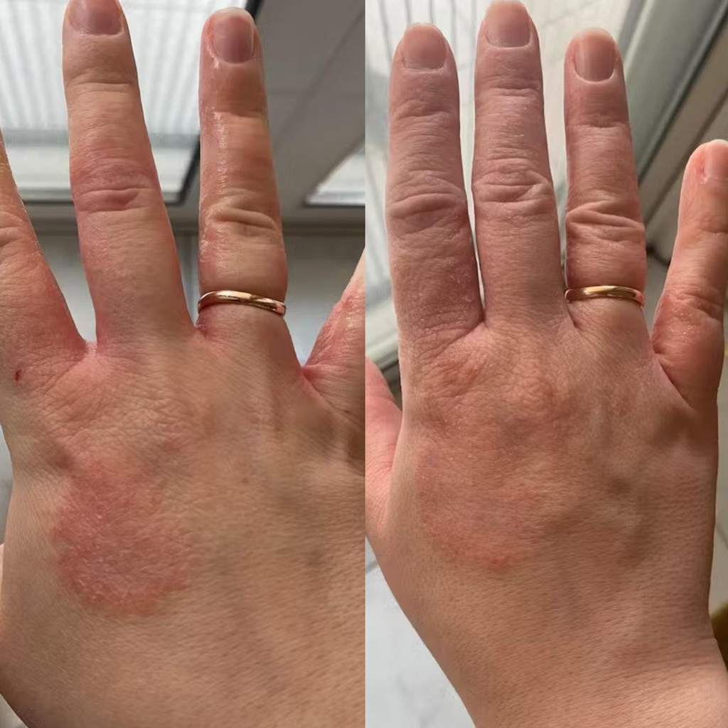 Organic Chamomile water - Hydrolina for Eczema and Irritated skin
