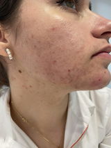 Katerina review photo