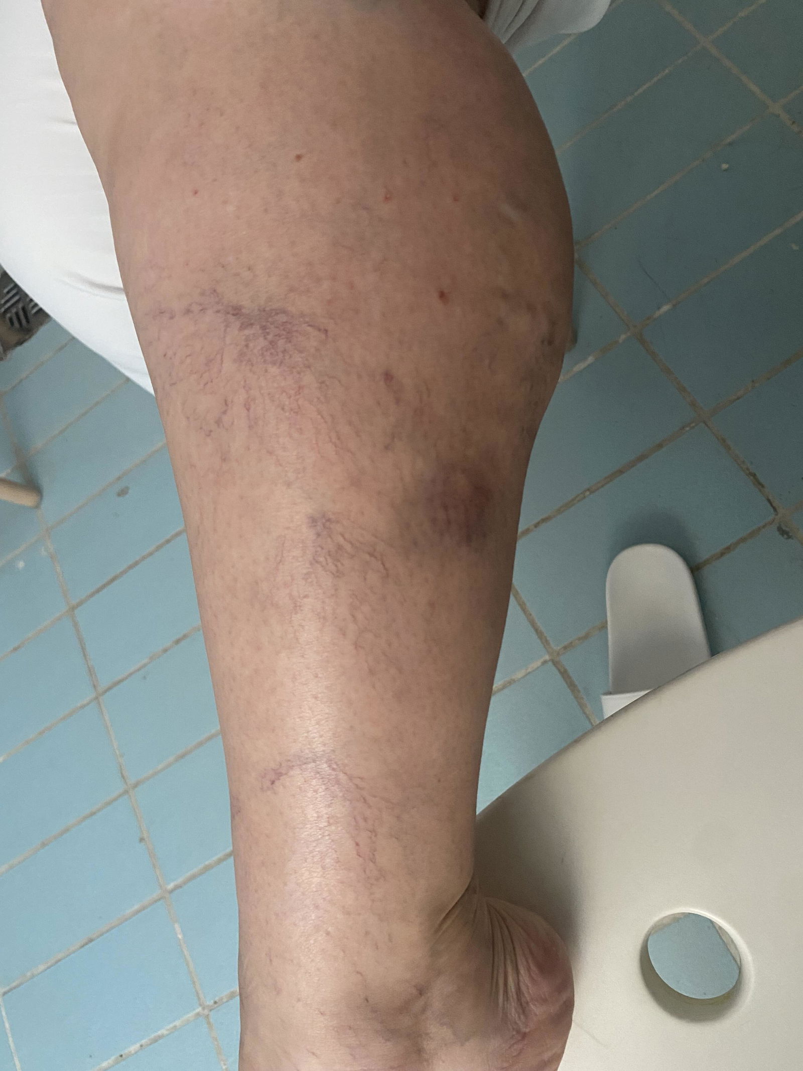 Φωτογραφία από κριτική αγοραστή για την κρέμα με αγριοκαστανιά της InaEssentials