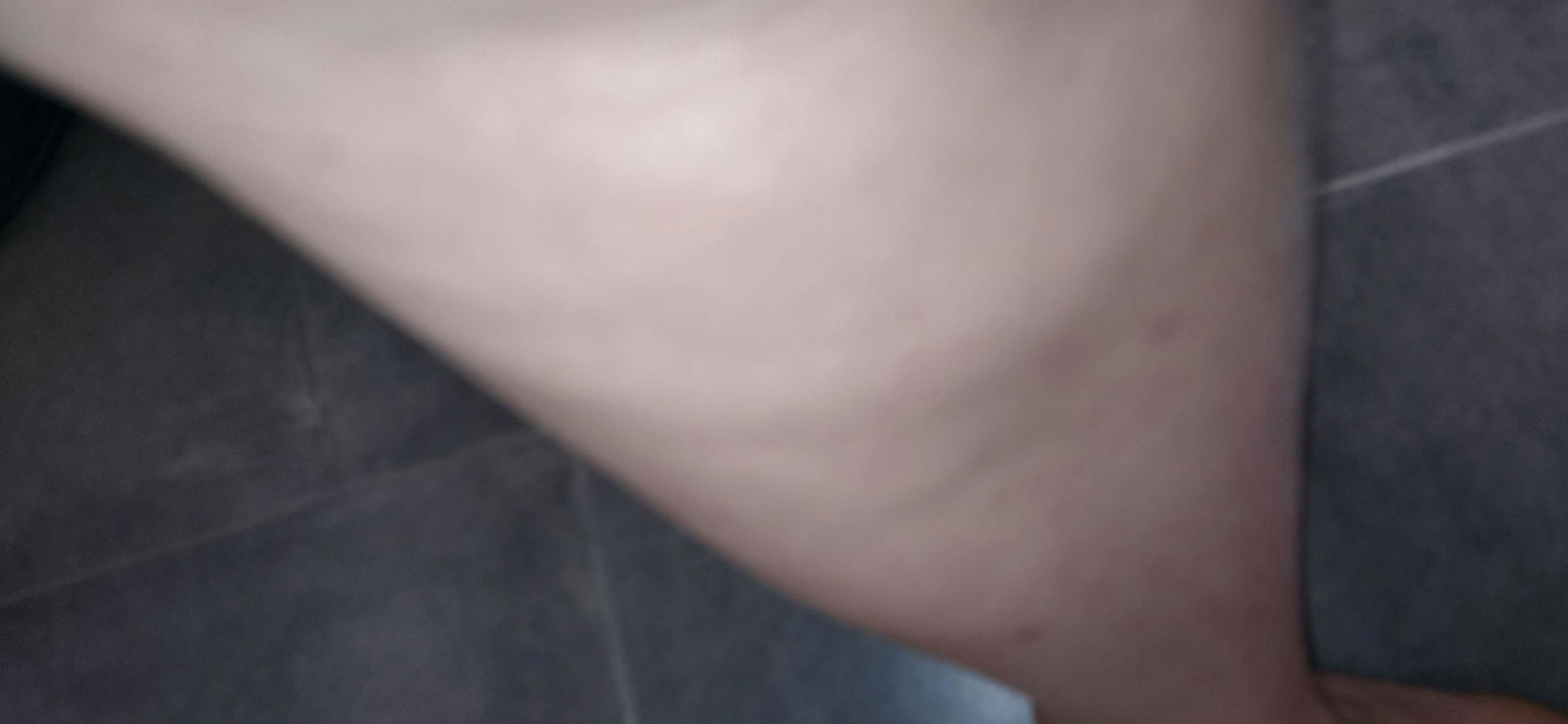 Foto aus einer Käuferbewertung zur Creme mit Rosskastanie von InaEssentials