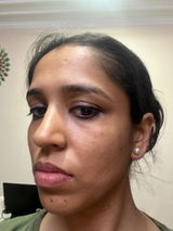 Akanksha review photo